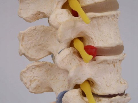 NAUKOWY MODEL ANATOMICZNY 3B SCIENTIFIC A795 ZWYRODNIENIE KREGÓW