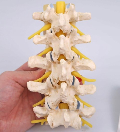 NAUKOWY MODEL ANATOMICZNY 3B SCIENTIFIC A795 ZWYRODNIENIE KREGÓW