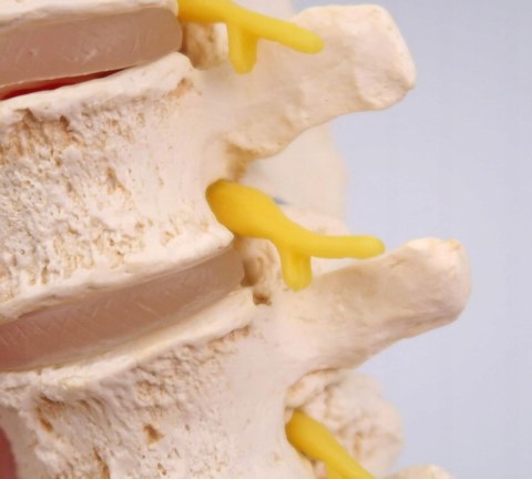 NAUKOWY MODEL ANATOMICZNY 3B SCIENTIFIC A795 ZWYRODNIENIE KREGÓW
