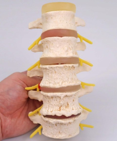 NAUKOWY MODEL ANATOMICZNY 3B SCIENTIFIC A795 ZWYRODNIENIE KREGÓW